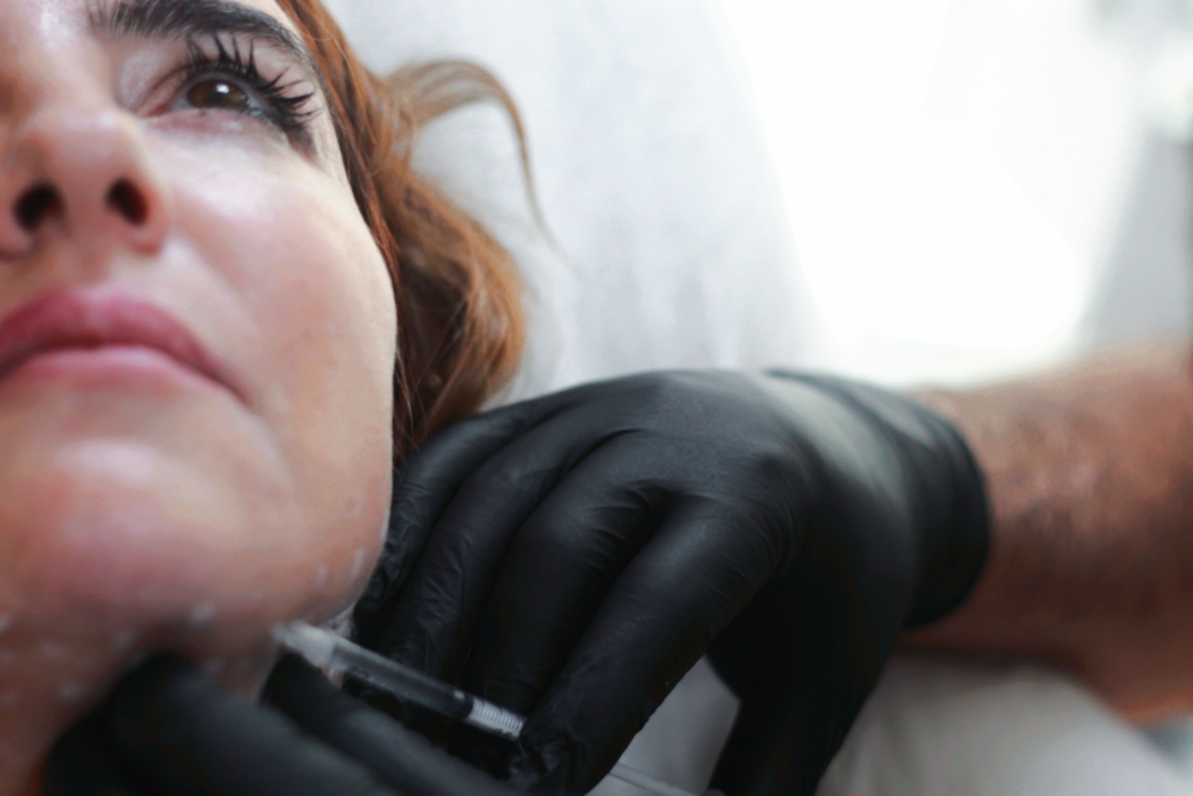Dermal Fillers vs Skin Boosters vs Profhilo vs SkinVive: A Nurse’s Comparison