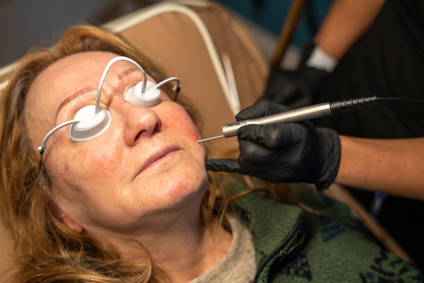 Why am I seeing more wrinkles, and what are my honest treatment options?